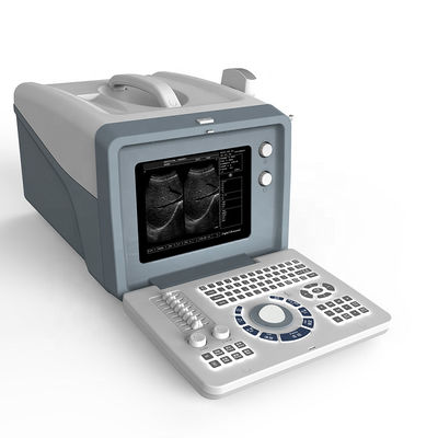 품질  Ultrasound laptop diagnostic ultrasound machine /black and white ultrasound scanner with 15 inch LCD screen 공장