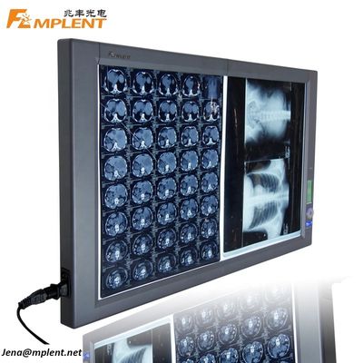 품질  Super Bright Digital Dual General Film Medical Negatoscope LED X Ray Viewer 공장