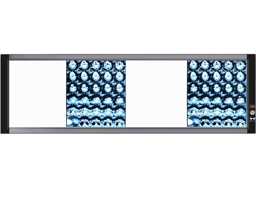 Ultra Thin Metal Hospital Quadruple Union LED X-ray Film Negatoscope