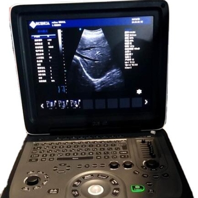 Medical Electronic Device Ecografo Echo Model Metal Connectors RUIHUA DU8-M1 Advanced Two Laptop Doppler Ultrasound Machine